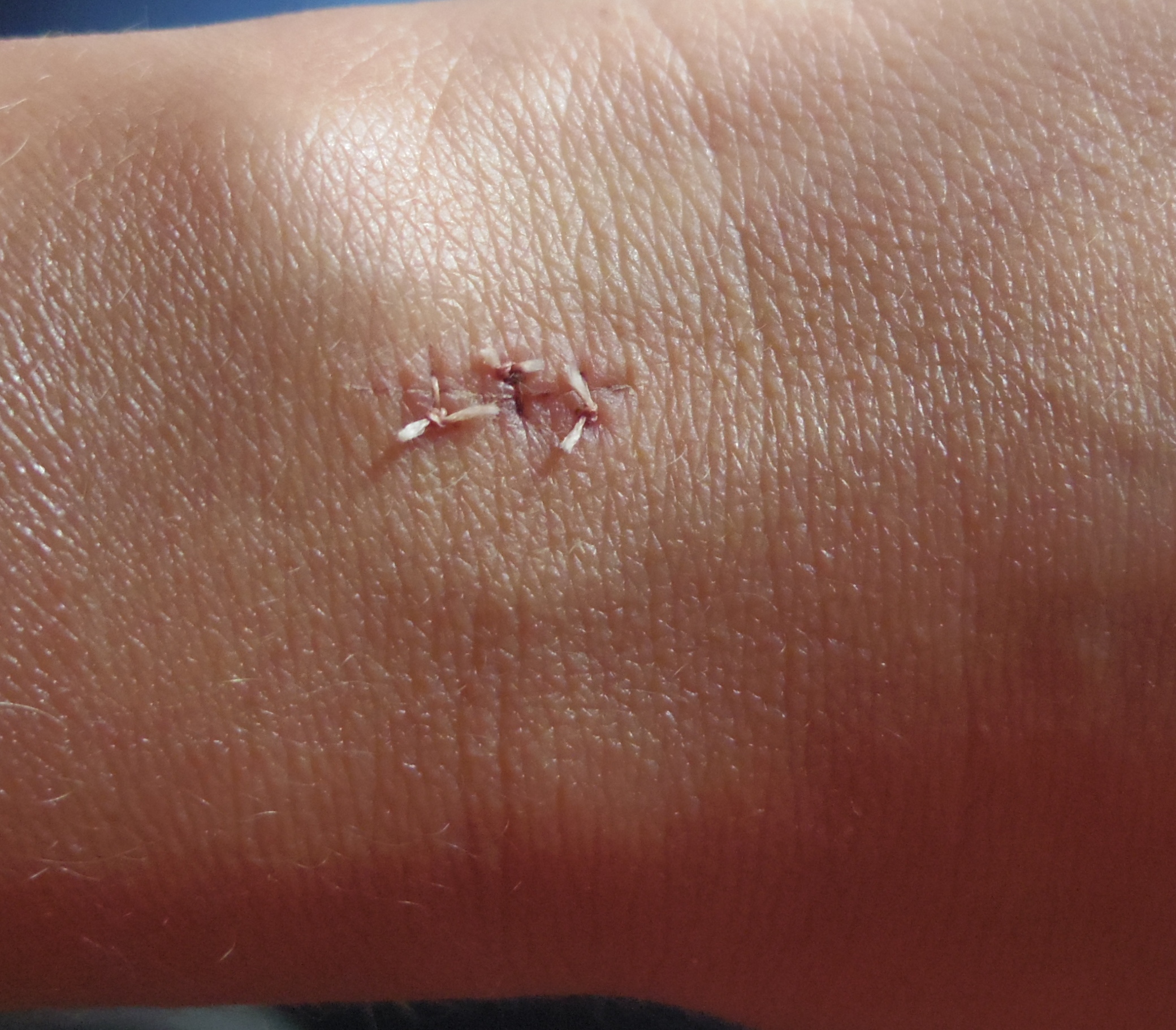 cicatrice Miel Flavie Dode Naturopathie Réflexologies Bien-être